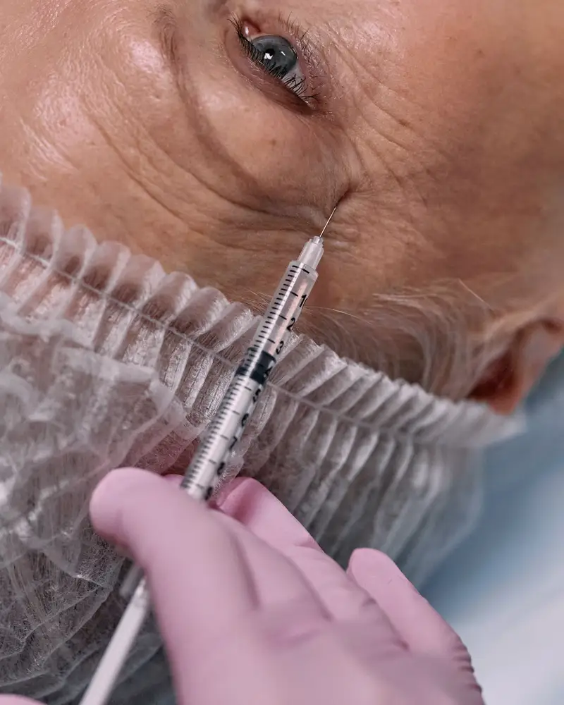 Gloved injector placing filler near the cheekbone of a woman in her sixties lying back on a treatment chair