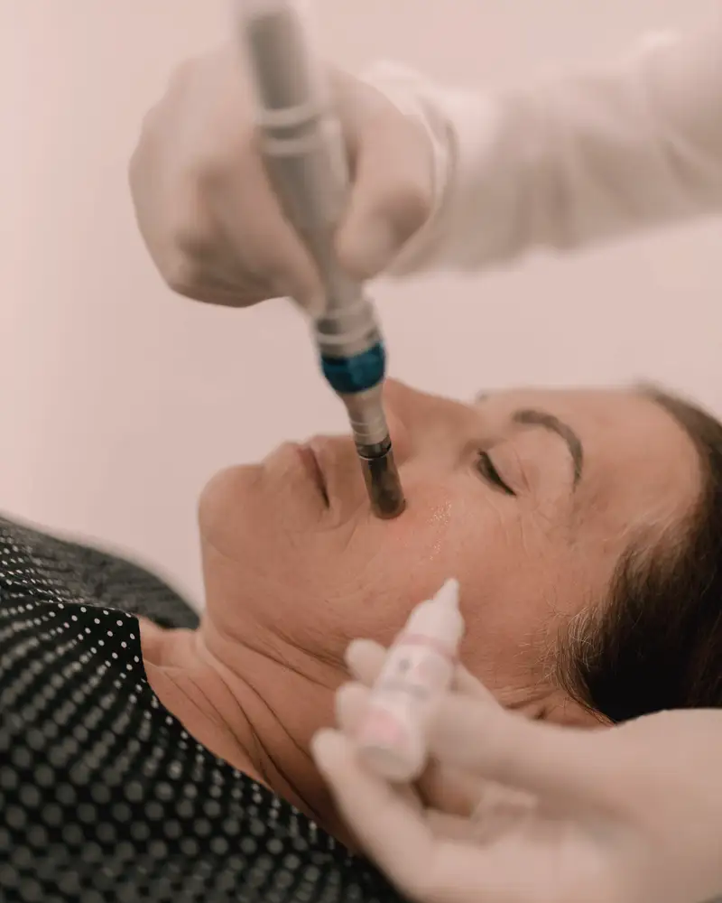 Esthetician running a microneedling pen across the jaw of a client lying on a white treatment bed